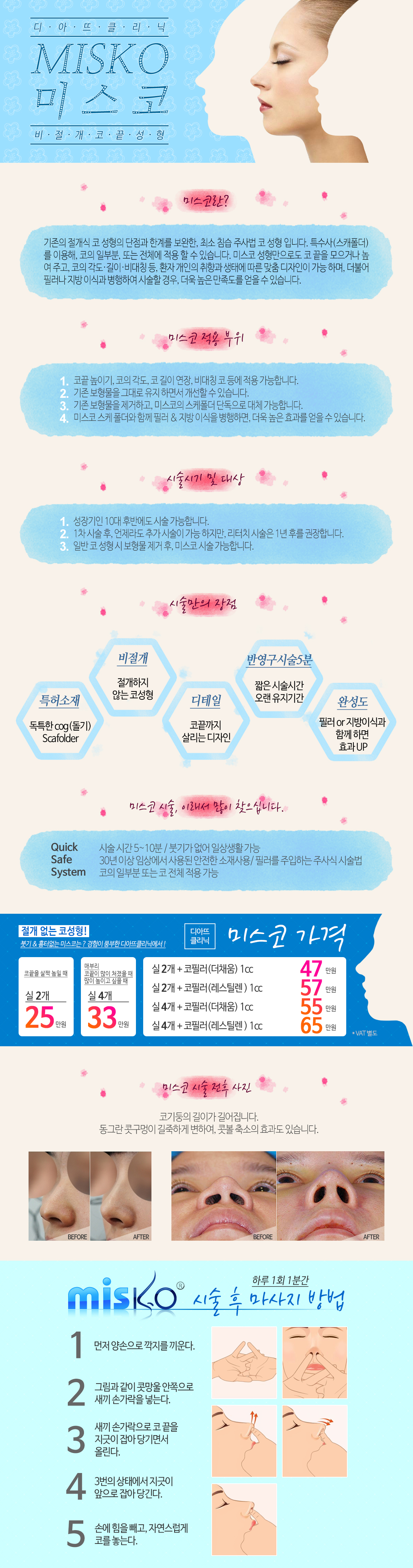 미스코 크롭 안내 이미지 1